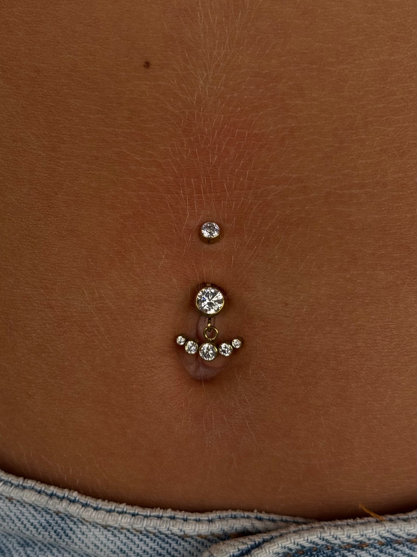 Navel Cluster